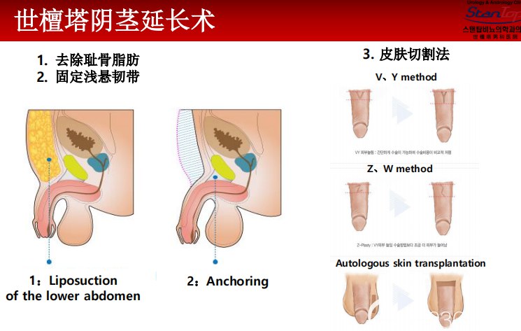《关于丁丁的增长增粗》简介：本书提供了关于关于丁丁的增长增粗的深度解析，涵盖其发展背景、核心概念以及实际应用